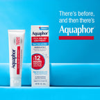 Aquaphor Children's Itch Relief Ointment, 1% Hydrocortisone Anti Itch Ointment for Skin Irritation, Insect Bites, Psoriasis, Skin Rashes Eczema & Poison Ivy, Fragrance Free, 1 Oz Tube, Pack of 2